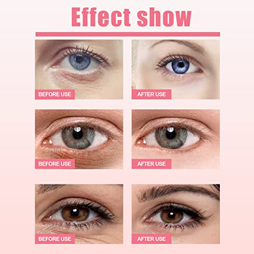 חידוש נוסף של רוזה עין, מזור עיניים קומפקטי אנטי-קמטים, מזרן עיניים לחות ומבהיר, קרם לתיקון עיניים,