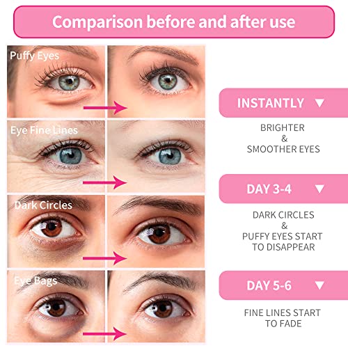 מסכת עיניים ורודה ורודה של בריייל - 30 זוגות - מתחת למסכת עיניים חומצה אמינית וקולגן, מתחת למסכת עיניים לטיפול
