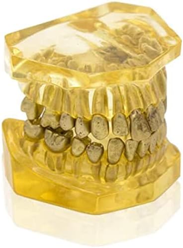 מודל הוראה, שיניים הוראת מחקר דגם - עקירת שן אורתודונטי תרגיל דגם-שיניים אנטומי דגם להסרה שיניים