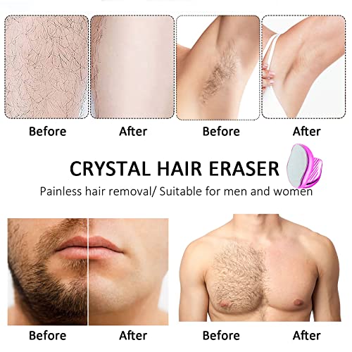 קריסטל שיער מחק, משודרג קסם קריסטל שיער מסיר עבור נשים וגברים, ללא כאבים קילוף שיער הסרת כלי