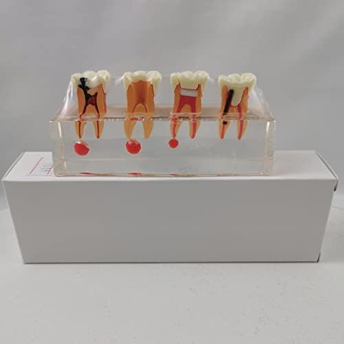 66זקי שורש שן דגם שיניים פה דגם אדם שיניים דגם שן צחצוח דגם להוראה לומד