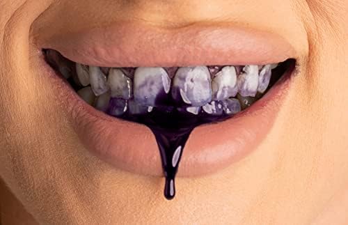 צרור הלבנת שיניים של SPARX, כולל מברשת שיניים חשמלית, משחת שיניים מתקנת צבע ומארז נסיעות - לבן