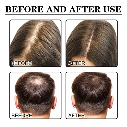 2 יחידות אלוריום שיער צמיחת סרום לנשים שחורות, אלוריום יופי שיער צמיחת סרום אנטי שיער אובדן להזין יבש